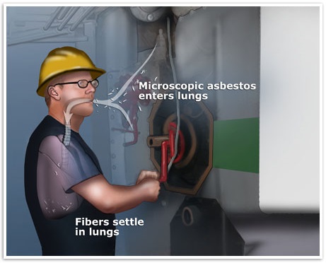 How asbestos causes mesothelioma